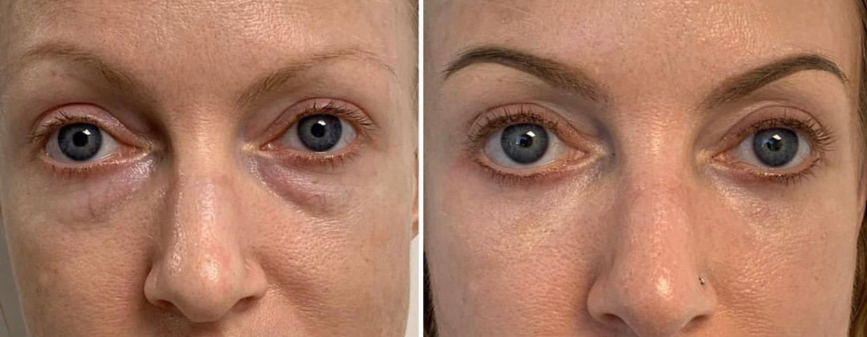 Lumére Instant Under-Eye Tightener