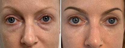 Lumére Instant Under-Eye Tightener